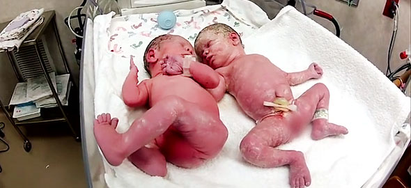 neogennita_didima_590_b