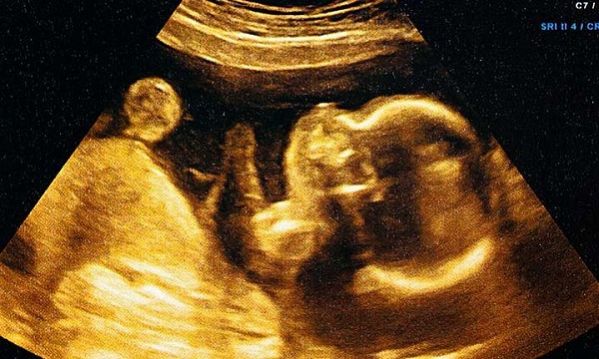 faf1e6bf8df9fd7e9d2c20a5b35cdcda_L